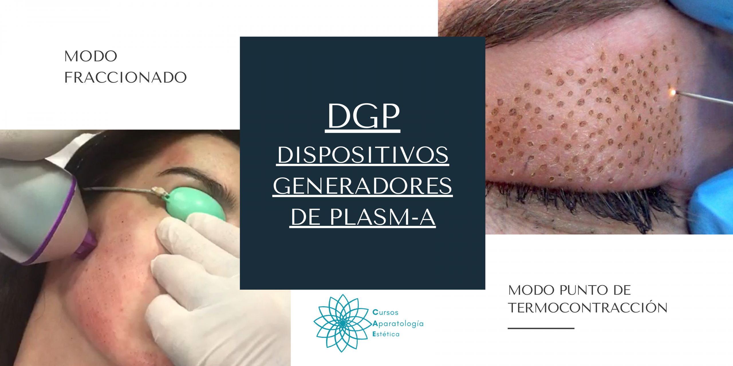 DPG (Dispositivos Generadores de Plasma) para Rejuvenecimiento Facial