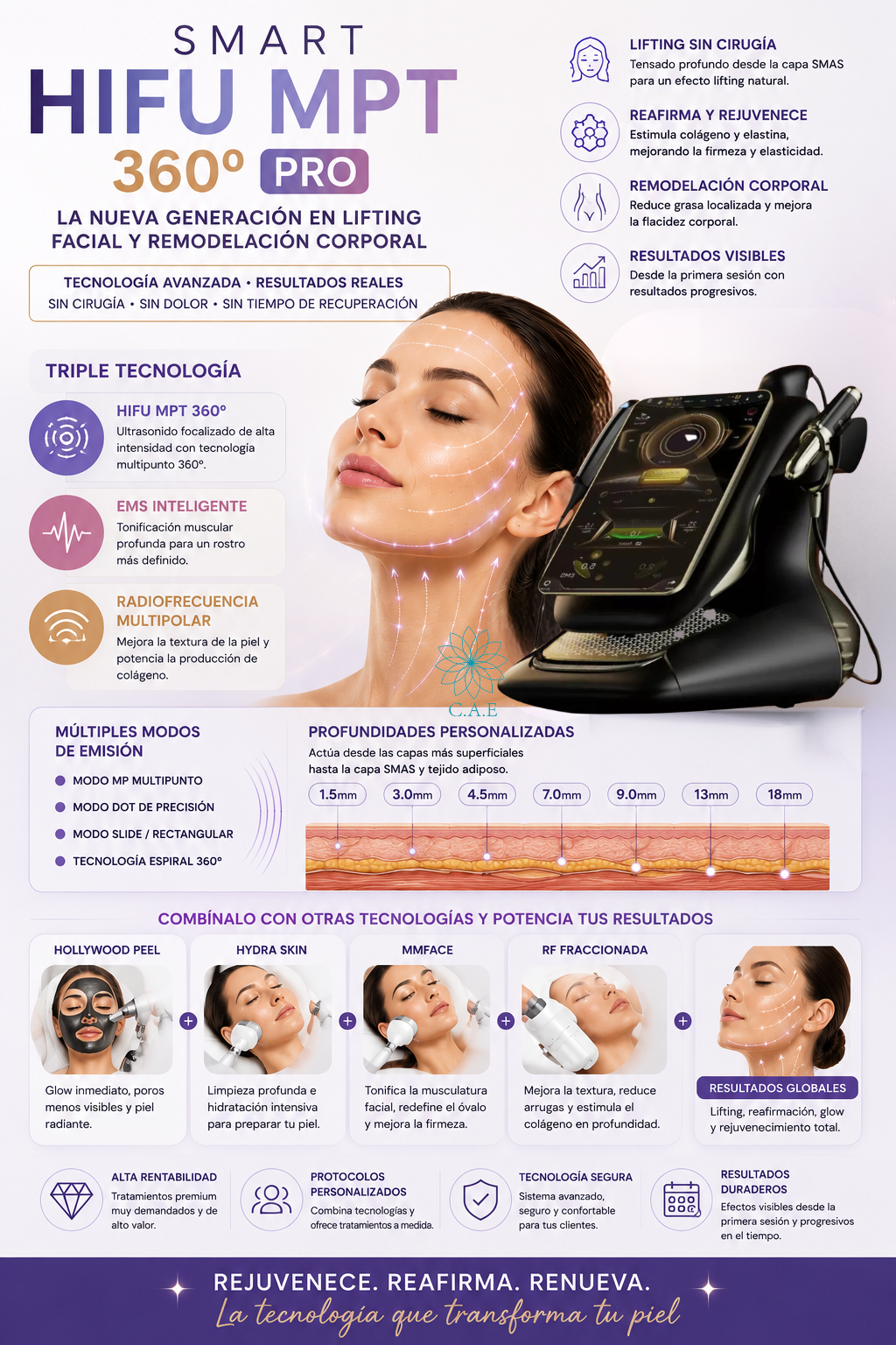 ✨ Ventajas de SMART HIFU MPT 360º