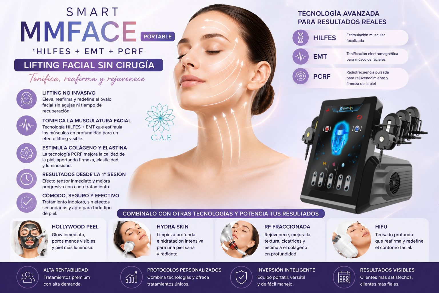 ✨ Ventajas de SMART MMFACE
